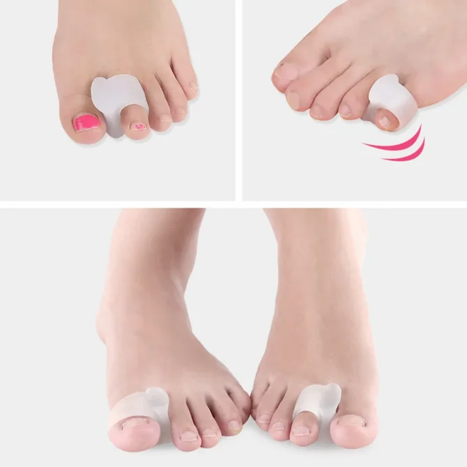 Silicone Toes Separator Bunion Adjuster Outer Foot Care Tools Hallux Valgus Corrector 1-10 Pairs - Image 4