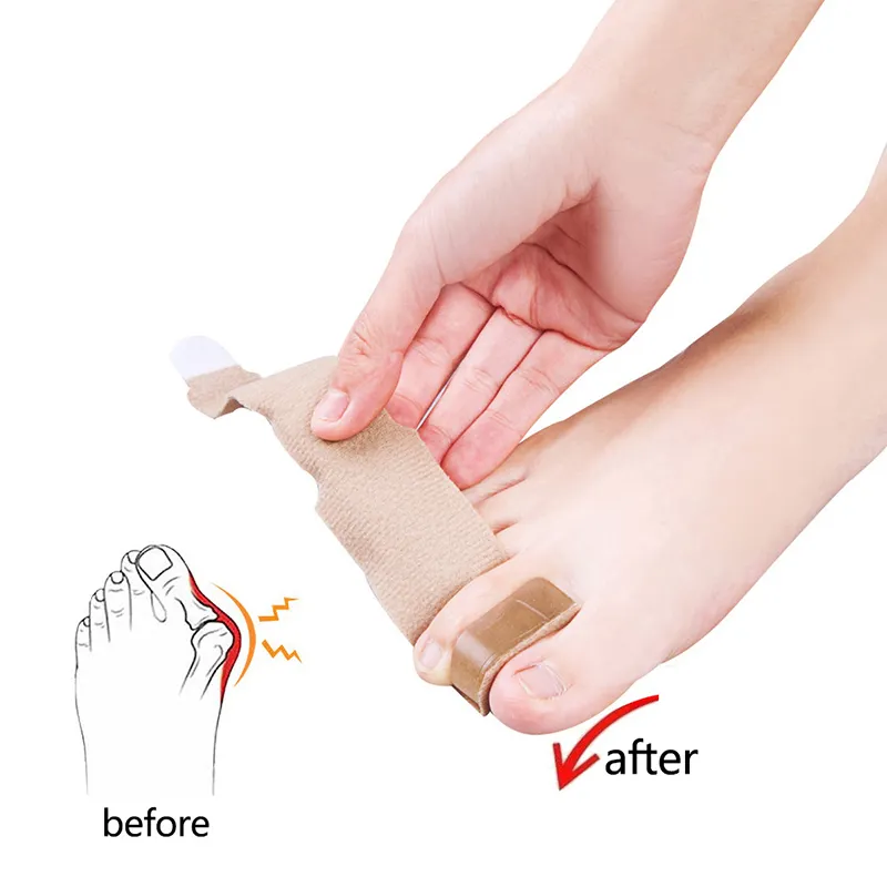 1Pcs Silicone Toe Spreader Separator Bunion Hallux Valgus Corrector Thumb Finger Correction Straightener Foot Care Tool