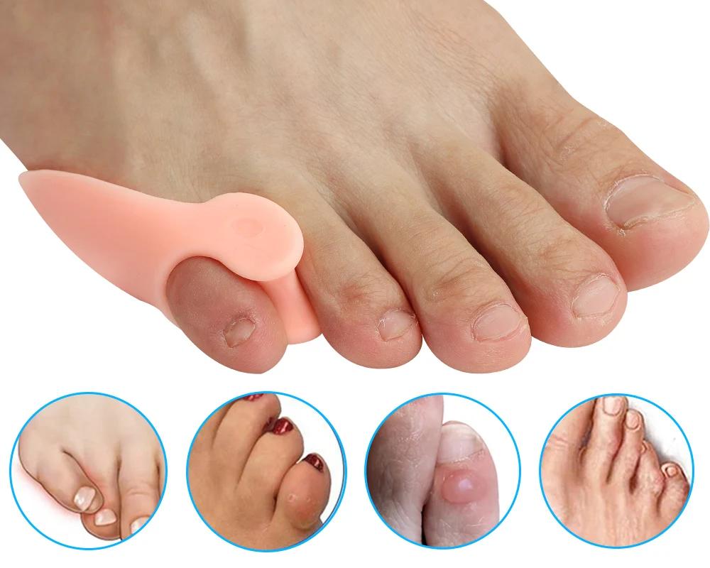 Pinky Toe Bunionette Corrector – Soft Gel Little Toe Separator Cushion