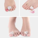 Silicone Toe Separator Set – Soft Gel Outer Foot Cushion (1–10 Pairs Available) - Image 4
