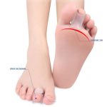 Gel Bunion Protector Toe Separator – Soft Silicone Cushion for Everyday Comfort (1 Pair)
